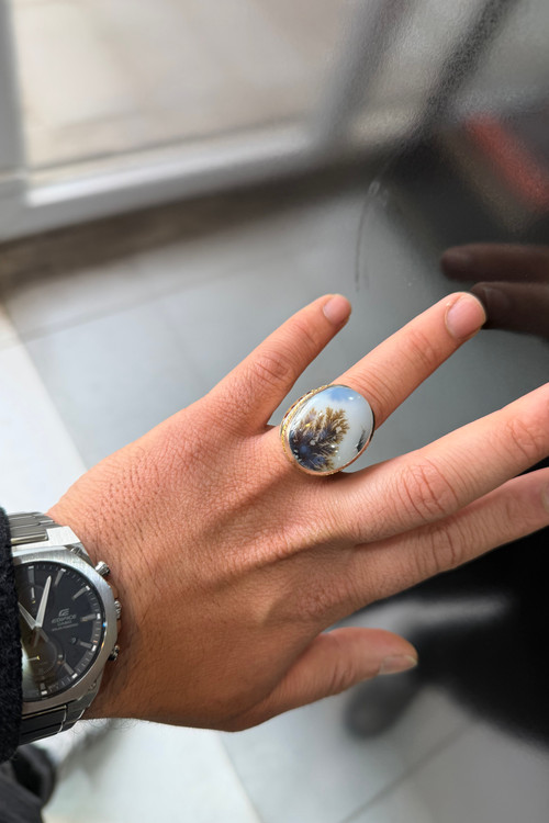 نمای روی دست